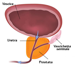 unico farmaco per prostata e disfunzione erettile durere prostatita